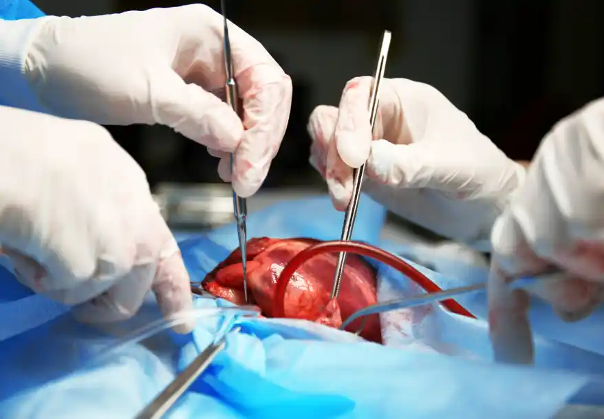 Chirurgie cardiovasculaire de haute précision