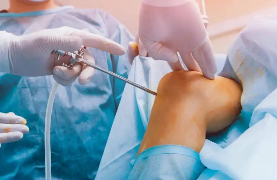 Chirurgie du genou & orthopédie